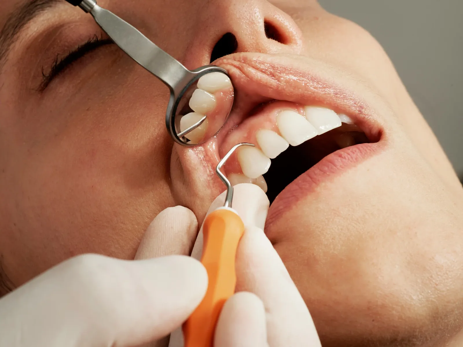 Dental cleaning and exam at Dr. J. David Dudley & Associates in Unionville