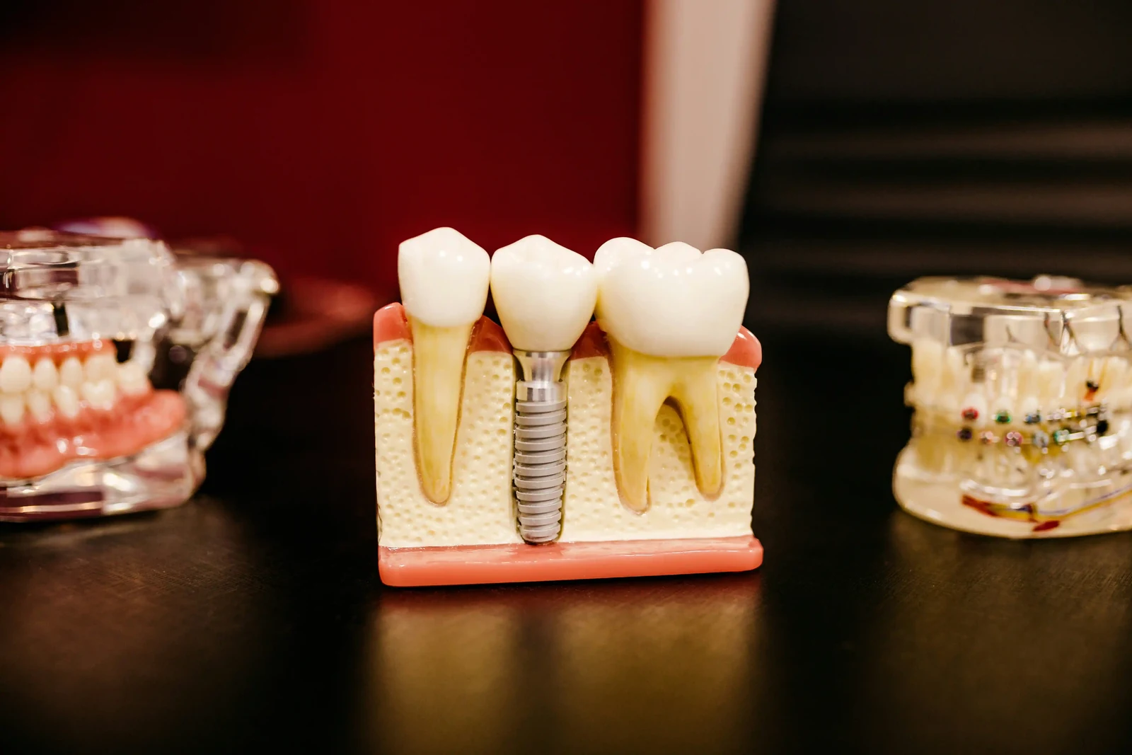 Restorative care at Dr. J. David Dudley & Associates in Unionville
